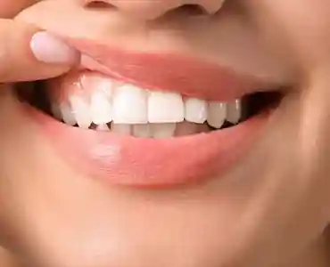 آیا کامپوزیت باعث پوسیدگی دندان میشود؟