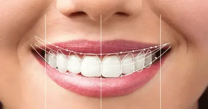 افزایش طول عمر ایمپلنت دندان