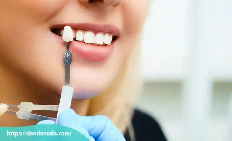 کاربردهای کامپوزیت ونیر