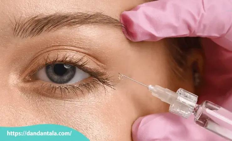 مراقبت های پس از تزریق فیلر چشم