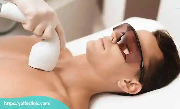 عوامل تاثیرگذار بر هزینه لیزر موهای زائد
