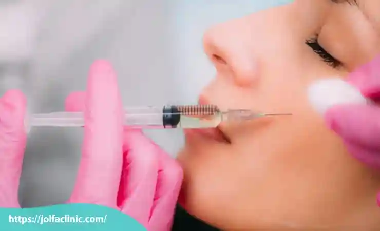 مراحل تزریق ژل گونه
