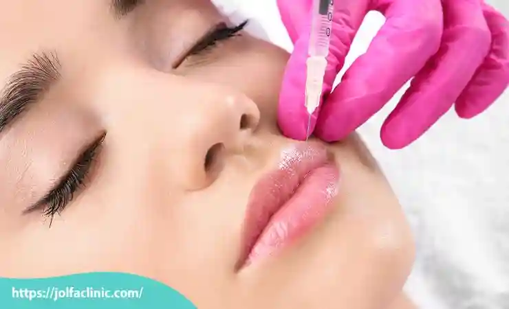 مراقبت بعد از تزریق ژل لب