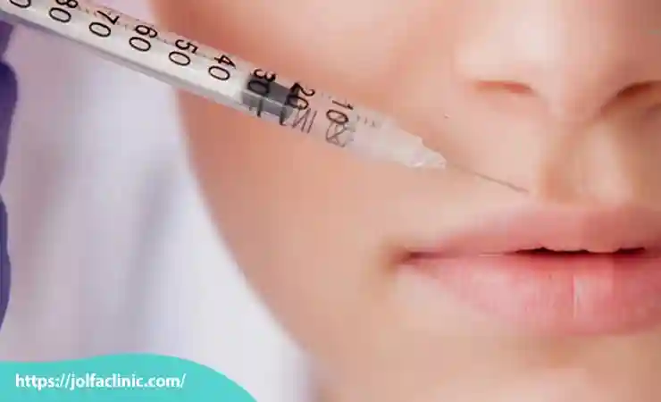 مراقبت قبل از تزریق ژل لب