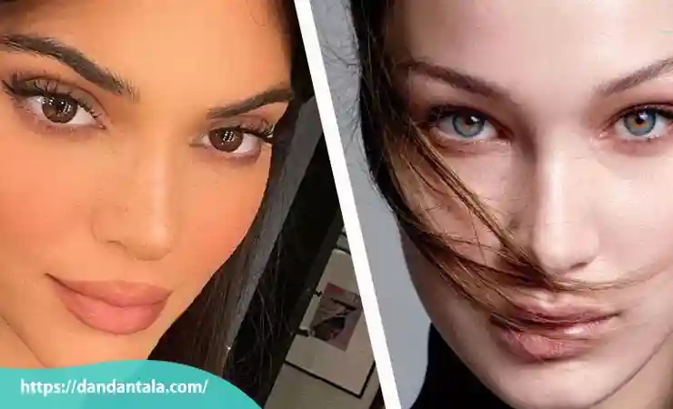 بوتاکس چشم گربه ای
