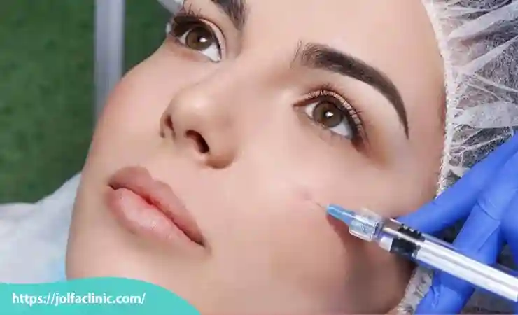 قیمت ژل گونه