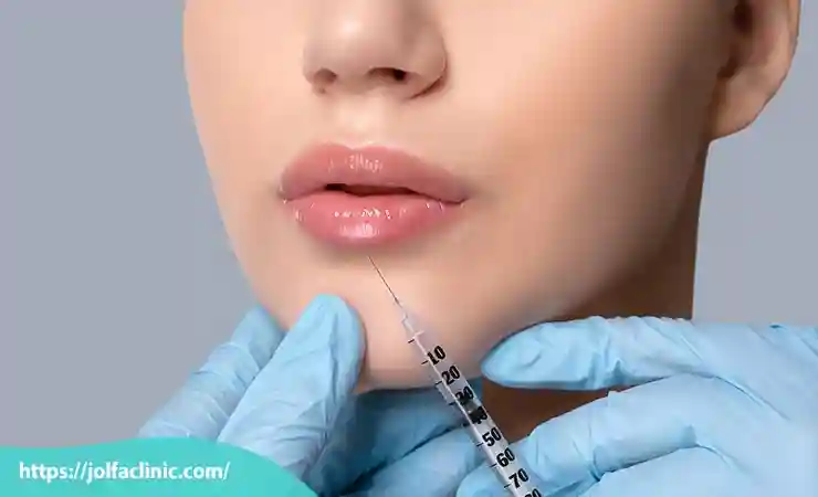 هزینه تزریق ژل لب دائمی