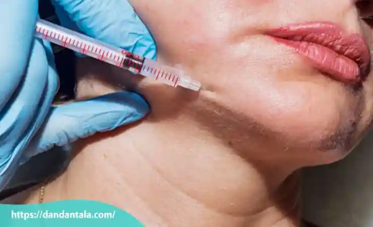 تزریق ژل در نواحی هدف