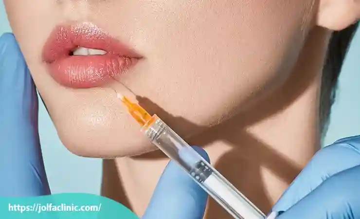 تزریق ژل لب دائمی