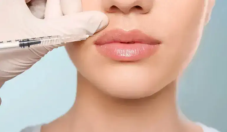 تزریق ژل لب