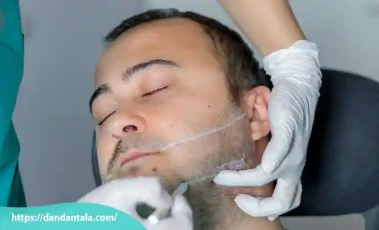 مزایای زاویه سازی فک با تزریق ژل