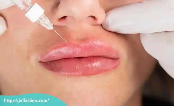 انواع مدل های تزریق ژل لب