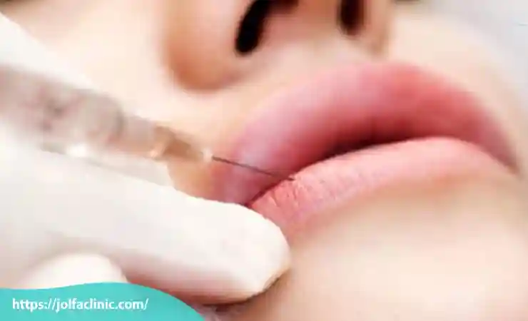 مراقبت های پس از تزریق
