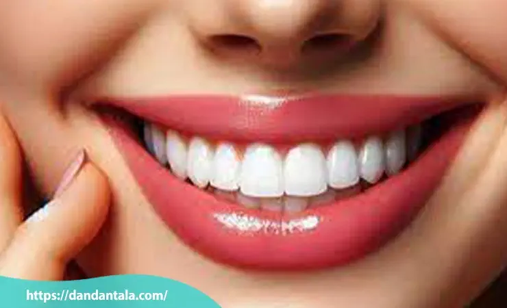 مراقبت های بعد از لمینت سرامیکی دندان