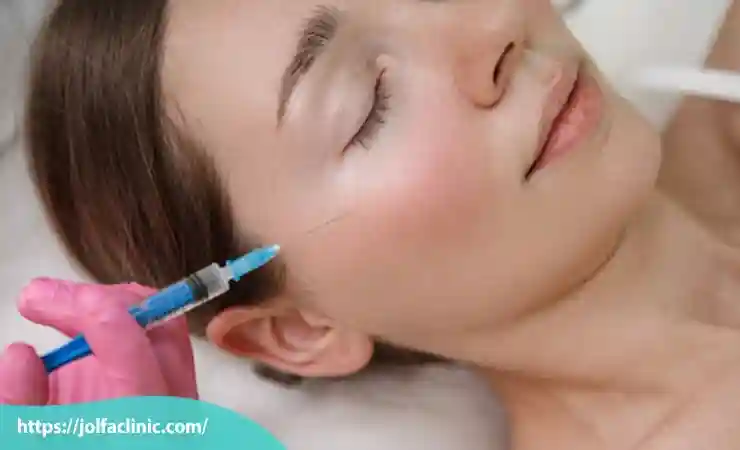 ماندگاری تزریق ژل گونه