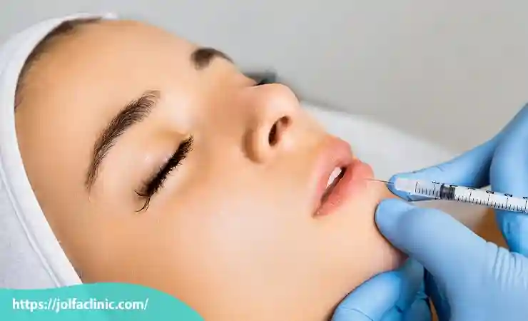 هزینه تزریق ژل لب