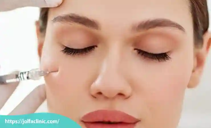 انجام تزریق فیلر زیر چشم