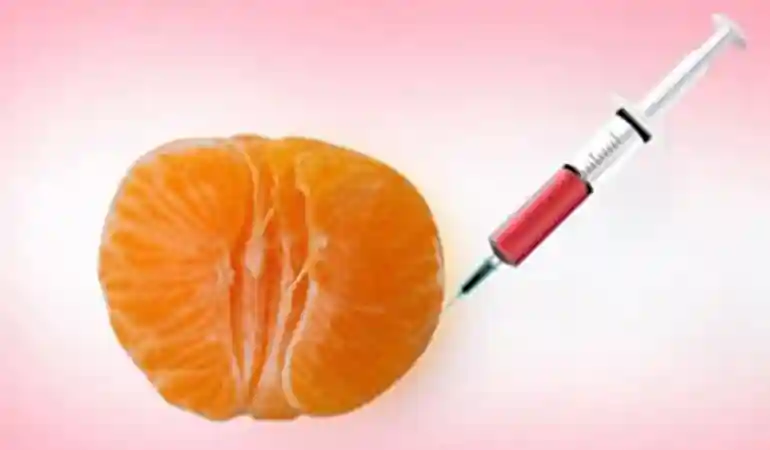 تزریق ژل واژن