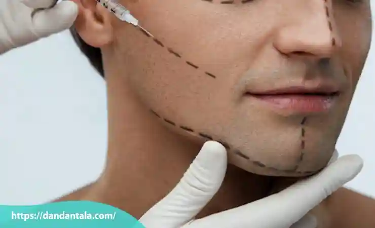 معایب زاویه سازی فک با تزریق ژل