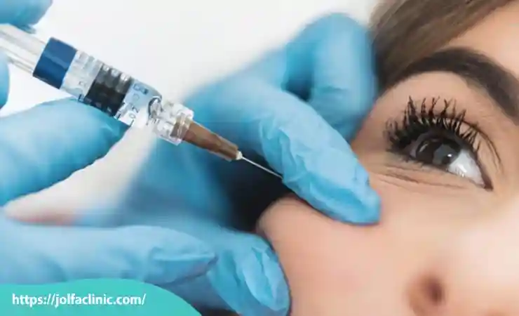 تزریق ژل گونه