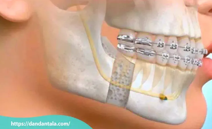 چه افرادی به جراح فک و صورت نیاز دارند؟
